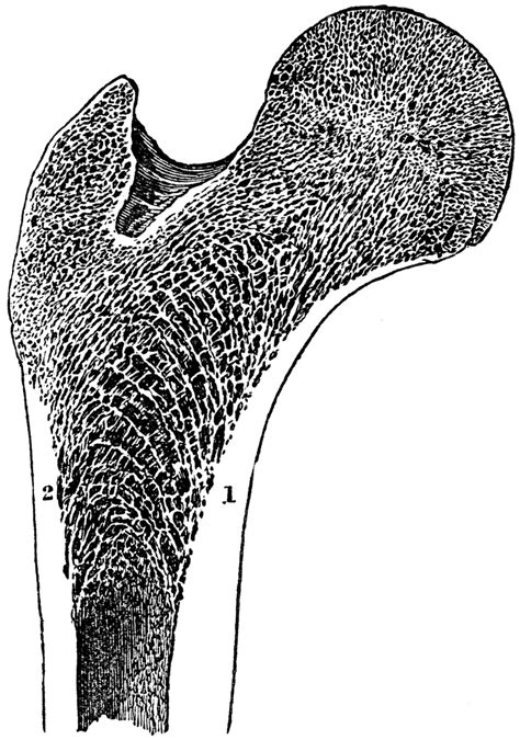 Cross section of the kidney with a stone 177 kb | 623 x 920 jpg Longitudinal Section of the Femur | ClipArt ETC