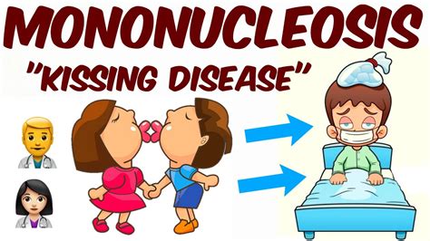 Mononucleosis Kissing Disease Youtube