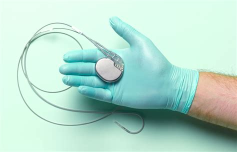 How An Implantable Defibrillator Affects Your Lifestyle