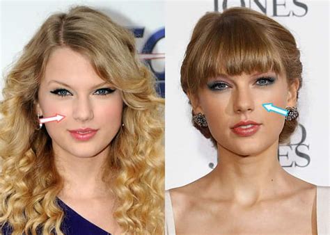 Did Taylor Swift Get Plastic Surgery Before And After Photos 2022