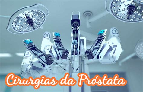 Cirurgias da próstata Instituto Ellos de Medicina