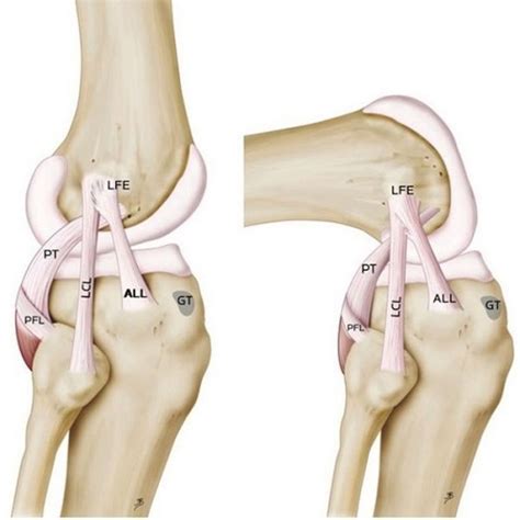 A broken leg ligament would seem to suggest that one of them is broken. Knee-Ligaments-1024x1024.jpg