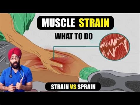 For instance if we are not training our core muscles properly, our back muscles will begin to overwork, thus resulting in pain, or strained muscles. मासपेशी में दर्द | What to Do if you get a Muscle Strain ...