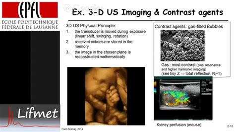 Ultrasound Imaging Examples 3d And Contrast Agents Youtube