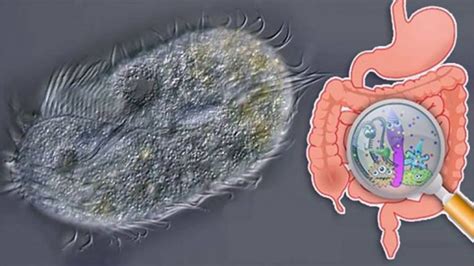 Amebíase O Que é Sintomas E Tratamentos Cura Natural