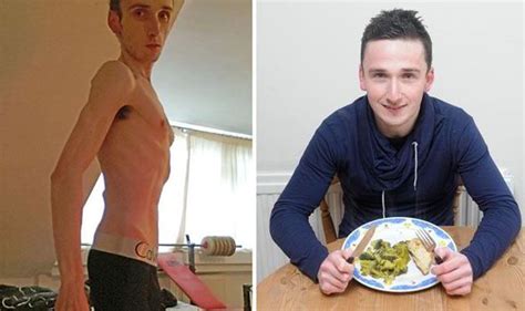 Anorexic Footballer Recovers From Eating Disorder By Bodybuilding