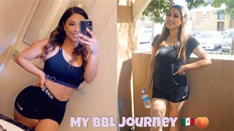 Bbl means be back later. I WENT TO MEXICO TO GET PLASTIC SURGERY?!!! | BBL UPDATE 6 ...