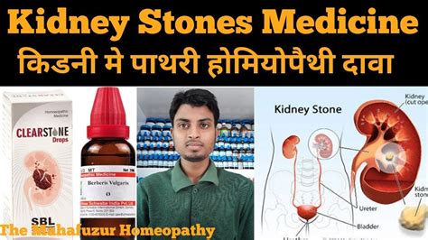Kidney Stones Homoeopathic Medicine By The Mahafuzur Homeopathy Youtube