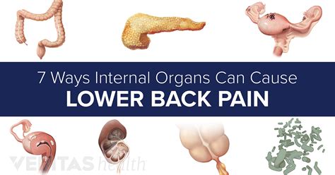 Slideshow 7 Ways Internal Organs Can Cause Lower Back Pain