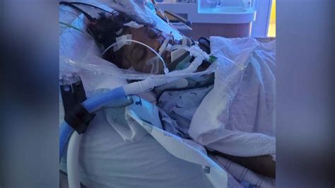 teen girl recovering a month after being struck by hit and run driver in clifton heights