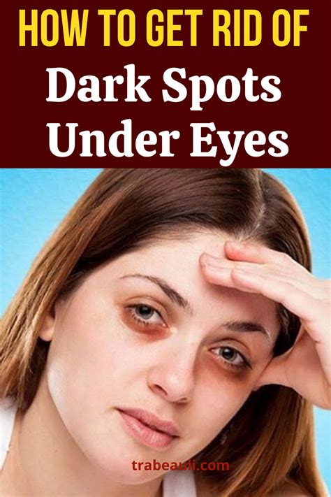 Read About How To Get Rid Of Dark Spots Under Eyes At Home We Have Listed Natural Home Remedies