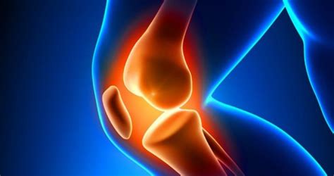 desgaste del cartílago de la rodilla síntomas causas y tratamiento diario de una maratón