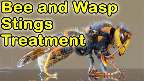 How To Treat Bee And Wasp Stings With Images Bee And Wasp Stings