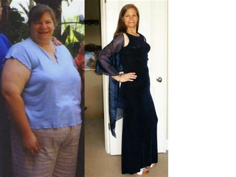 Check spelling or type a new query. 157 Raw Food Weight Loss Before and After Pictures ...