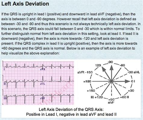 R Axis Deviation On Ecg Article Blog