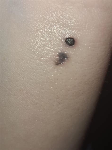 Done My First Poke About A Week Ago 7rl Started To Scab A Day Or Two