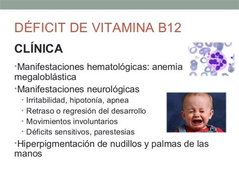 Déficit Vitamina B12