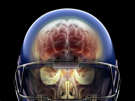 Super Bowl 2020 Football Concussions The Link Between Head Injuries