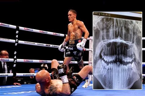 Menang Tko Josh Warrington Patah Rahang Usai Rebut Sabuk Juara Ibf