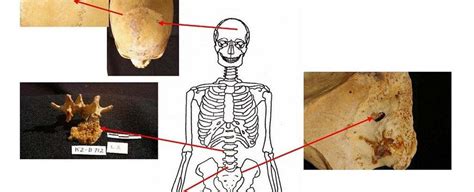 Cancer Discovered In Ancient Egyptian Remains Shows These Days We Have It Much Worse Nexus