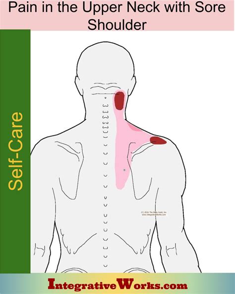 Self Care Neck Pain With Sore Shoulder Integrative Works