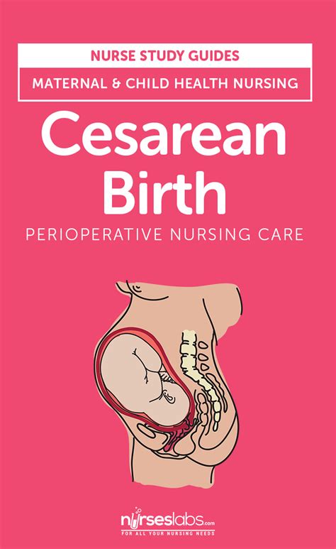 C Section Nursing Care Plan Using The Ability Model To Design And