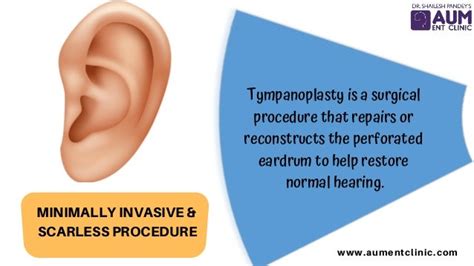 Endoscopic Tympanoplasty In Mumbai Best Ent Surgeon In India