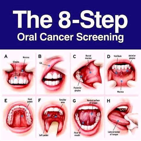 Oral Cancer Archives Overland Park Dentistry