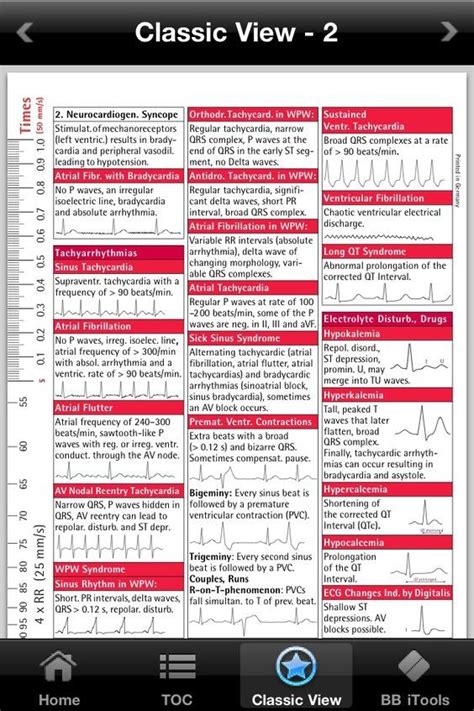 17 Best Images About Ekg On Pinterest Heart Medical Assistant And Nclex
