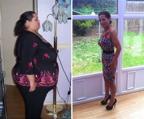 Obese Woman Rejects Gastric Band Op And Loses 20 Stone With Exercise