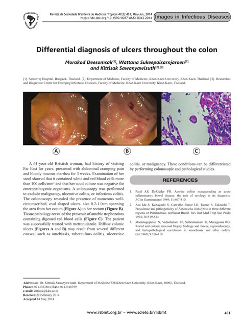 Pdf Differential Diagnosis Of Ulcers Throughout The Colon