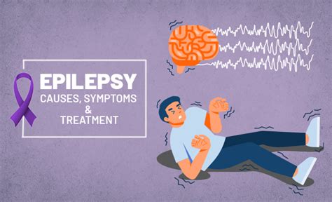 Epilepsy Causes Symptoms And Treatment Accord Hospital