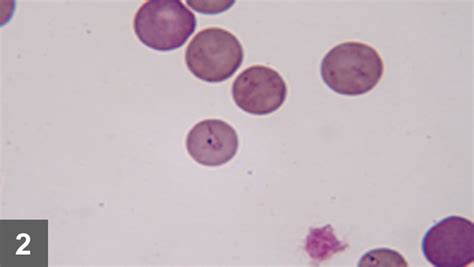 Diagnosing And Treating Babesiosis In Dogs Clinicians Brief