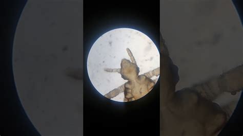 Head Louse Microscopic View Youtube