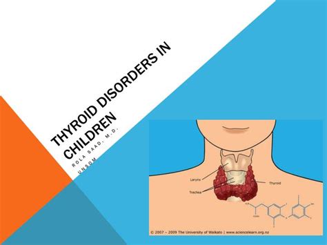 Ppt Thyroid Disorders In Children Powerpoint Presentation Free