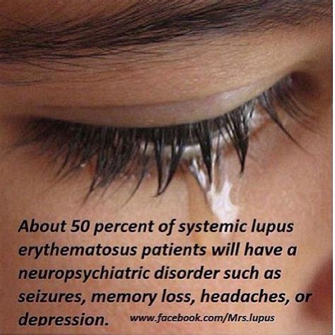 Photo By Realhousewifebx Lupus Lupus Ugh Pinterest