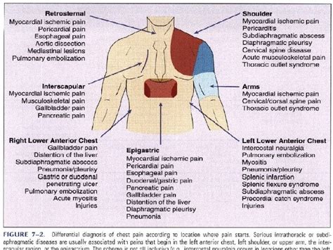 Anatomy Of Chest Pain Chest Pain Thoracic Key Pricking Painful