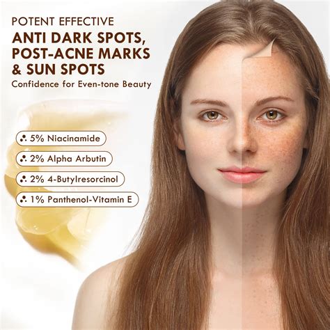 Buy Dark Spot Remover For Face Dark Spot Corrector Freckle Remover