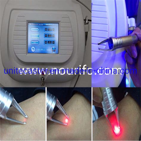 Professional Diode Laser 980nm Red Blood Vessels Spider Vein Removal