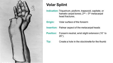 Splinter Series Common Ed Splint Techniques Splint Principles 104