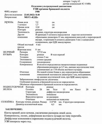 Желчнокаменная болезнь - схема лечения - Вопрос гастроэнтерологу - 03 Картинка - Желчнокаменная болезнь - схема лечения - Вопрос гастроэнтерологу - 03