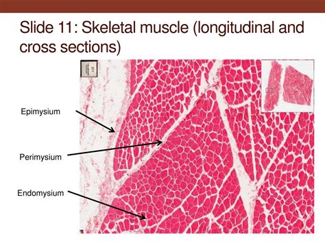 Skeletal Muscle Transverse Labeled