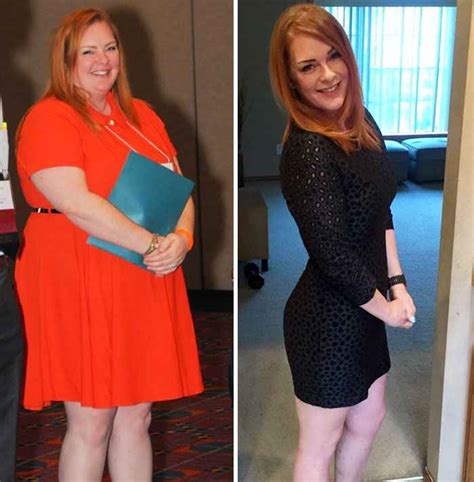 10 People Whose Weight Loss Journey Will Inspire You To Hit The Gym