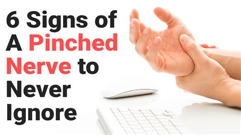 6 Signs Of A Pinched Nerve To Never Ignore Pinched Nerve Nerve Radiculopathy