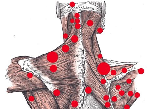Massage Therapy Do Trigger Points Exist Guardian Liberty Voice
