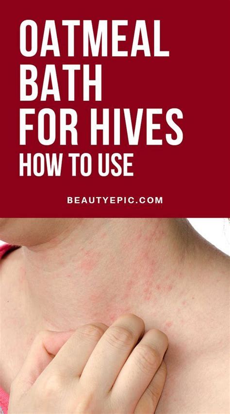 Oatmeal Bath Remedy For Hives How To Use Hives Remedies Natural