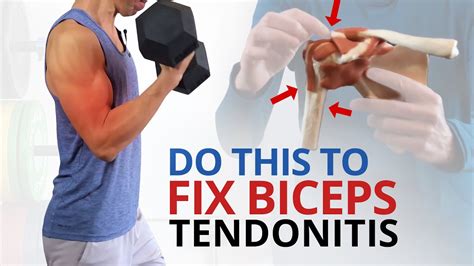 Biceps Tendonitis Exercises Pdf Aaos Augustine Childs