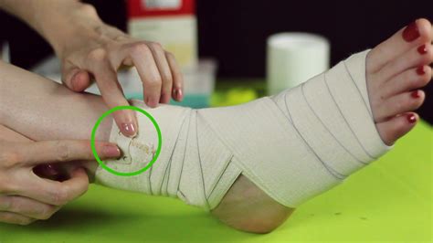 How To Wrap A Sprained Ankle 14 Steps With Pictures Wikihow