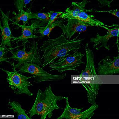 Blood Smear Micrograph Stockfotos En Beelden Getty Images
