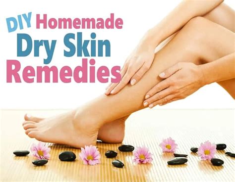 Diy Homemade Dry Skin Remedies Save Money With These Easy Diy Remedies